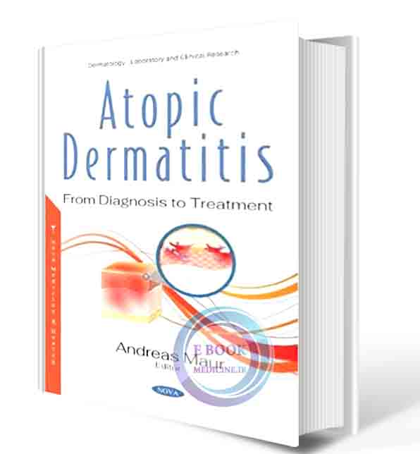 دانلود کتاب Atopic Dermatitis: From Diagnosis to Treatment  2020  (ORIGINAL PDF)